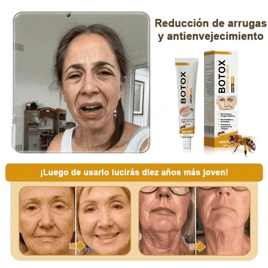 Crema Botox de Veneno de Abeja – Rejuvenecimiento Instantáneo